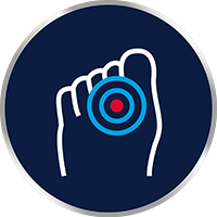 Srbeči, pekoči prostori med prsti na nogah?