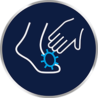 Glivična okužba kože se zlahka širi prek stika kože s kožo